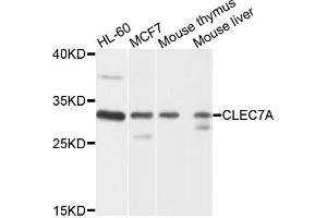 Western blot analysis of extracts of various cells, using CLEC7A antibody. (CLEC7A anticorps)
