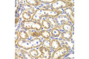 Immunohistochemistry of paraffin-embedded rat kidney using TNFSF11 antibody at dilution of 1:100 (400x lens). (RANKL anticorps)