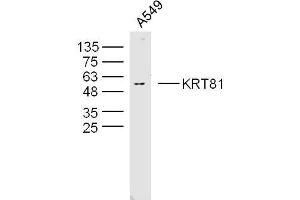 A594 lysates probed with KRT81 Polyclonal Antibody, Unconjugated  at 1:300 overnight at 4˚C.