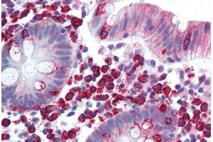 Colon, lamina propria plasma cells (LTK anticorps  (AA 800-864))