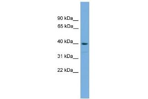 WB Suggested Anti-SAMSN1 Antibody Titration:  0. (SAMSN1 anticorps  (Middle Region))