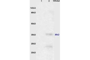 L1 mouse brain, L2 mouse liver lysates probed (ABIN670611) at 1:200 in 4 °C. (EpCAM anticorps  (AA 53-150))