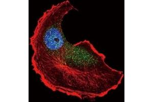 Confocal immunofluorescent analysis of phospho-TSC2 antibody with MCF-7 cells followed by Alexa Fluor 488-conjugated goat anti-rabbit lgG (green).