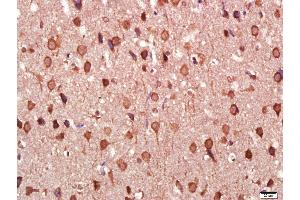 Paraformaldehyde-fixed, paraffin embedded Rat brain Antigen retrieval by boiling in sodium citrate buffer (pH6.