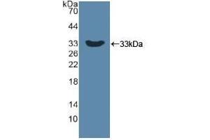 Detection of Recombinant DKK1, Human using Polyclonal Antibody to Dickkopf Related Protein 1 (DKK1) (DKK1 anticorps  (AA 33-266))