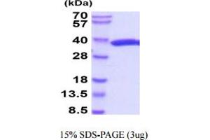 SDS-PAGE (SDS) image for Luciferase (AA 1-311) (Active) protein (His tag) (ABIN7281246) (Luciferase Protein (AA 1-311) (His tag))