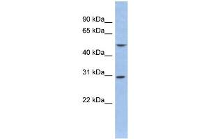 WB Suggested Anti-KCNIP2 Antibody Titration:  0. (KCNIP2 anticorps  (Middle Region))