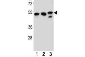 TUBB6 antibody western blot analysis in K562, HeLa, MDA-MB231 lysate.
