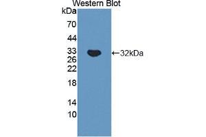 Western blot analysis of the recombinant protein. (TNXB anticorps  (AA 3824-4071))