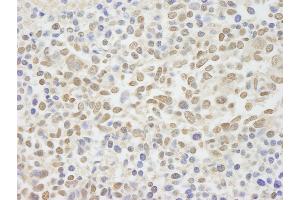 anti-Zinc Finger Protein 335 (ZNF335) (C-Term) antibody