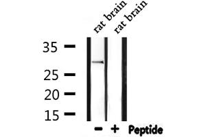 Western blot analysis of extracts from rat brain, using Ribosomal Protein S2 Antibody.