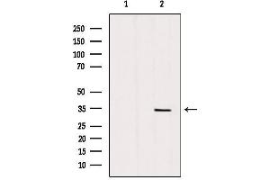 Western blot analysis of extracts from mouse brain, using SLC25A5 Antibody.