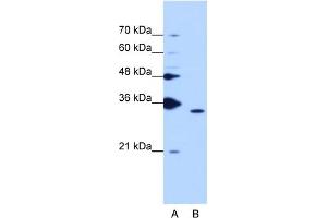 WB Suggested Anti-PPIE Antibody Titration:  1. (PPIE anticorps  (Middle Region))