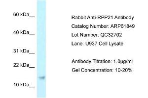 Western Blotting (WB) image for anti-Ribonuclease P/MRP 21kDa Subunit (RPP21) (Middle Region) antibody (ABIN2788924) (RPP21 anticorps  (Middle Region))
