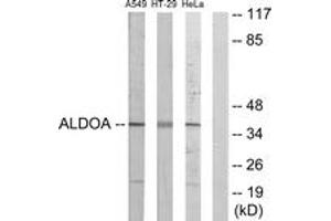 Western blot analysis of extracts from A549/HeLa/HT-29 cells, using ALDOA Antibody. (ALDOA anticorps  (AA 1-50))