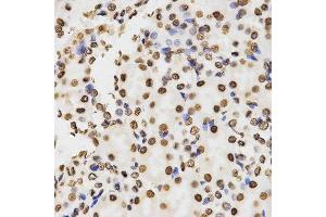 Immunohistochemistry of paraffin-embedded mouse kidney tissue using H3K9me2 antibody at dilution of 1:200 (x400 lens).