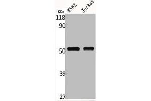 Western Blot analysis of K562 Jurkat cells using Glut1 Polyclonal Antibody