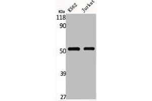 Western Blot analysis of K562 Jurkat cells using Glut1 Polyclonal Antibody (GLUT1 anticorps  (C-Term))