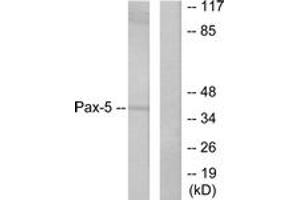 Western blot analysis of extracts from 293 cells, using Pax-5 Antibody. (PAX5 anticorps  (AA 1-50))