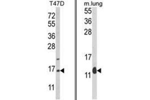 (LEFT) Western blot analysis of PEA-15 Antibody (C-term) in T47D cell line lysates (35ug/lane). (PEA15 anticorps  (C-Term))