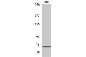 Western Blotting (WB) image for anti-Mitochondrially Encoded NADH Dehydrogenase 5 (MT-ND5) (Internal Region) antibody (ABIN3185786)