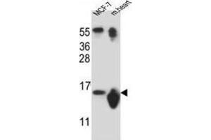 Western Blotting (WB) image for anti-Small Nuclear Ribonucleoprotein D3 Polypeptide 18kDa (SNRPD3) antibody (ABIN2912095) (SNRPD3 anticorps)