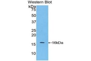 WB of Protein Standard: different control antibodies against Highly purified E.