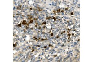 IHC analysis of GFI1 using anti-GFI1 antibody (ABIN7599380). (GFI1 anticorps  (AA 1-422))