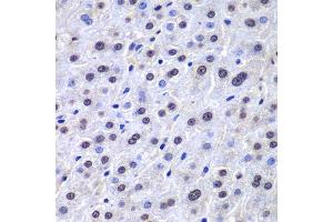 Immunohistochemistry of paraffin-embedded human liver injury using APEX1 antibody.
