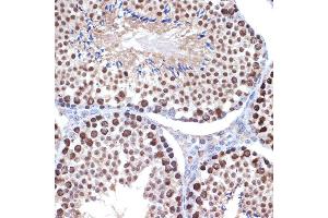 Immunohistochemistry of paraffin-embedded mouse testis using HMGB2 Rabbit mAb (ABIN7267649) at dilution of 1:100 (40x lens). (HMGB2 anticorps)
