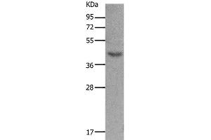 Western Blot analysis of Mouse muscle tissue using MC5R Polyclonal Antibody at dilution of 1:1200 (MC5 Receptor anticorps)