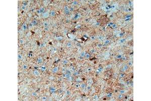IHC-P analysis of brain tissue, with DAB staining. (S100B anticorps  (AA 1-92))