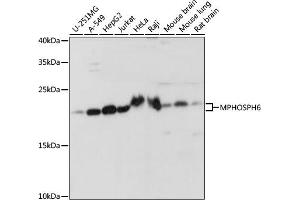 Western blot analysis of extracts of various cell lines, using MPHOSPH6 antibody (ABIN7268351) at 1:1000 dilution. (MPHOSPH6 anticorps  (AA 1-160))