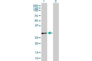 Western Blot analysis of PDLIM4 expression in transfected 293T cell line by PDLIM4 MaxPab polyclonal antibody. (PDLIM4 anticorps  (AA 1-246))