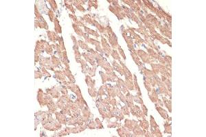 Immunohistochemistry of paraffin-embedded rat heart using A antibody (ABIN1678588, ABIN3015506, ABIN3015508 and ABIN6218562) at dilution of 1:100 (40x lens). (alpha 1 Adrenergic Receptor anticorps  (AA 346-475))