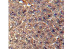 IHC-P analysis of Liver tissue, with DAB staining. (ITIH3 anticorps  (AA 279-467))