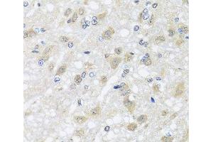 Immunohistochemistry of paraffin-embedded Rat brain using HARS2 Polyclonal Antibody at dilution of 1:100 (40x lens). (HARS2 anticorps)