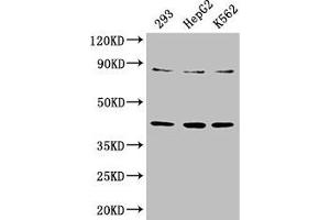 Western Blot Positive WB detected in: 293 whole cell lysate, HepG2 whole cell lysate, K562 whole cell lysate All lanes: PTPA antibody at 3.