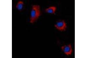 Immunofluorescent analysis of Claudin 2 staining in A431 cells. (Claudin 2 anticorps  (C-Term))