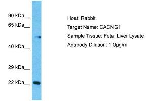 Host:  Rabbit  Target Name:  CACNG1  Sample Type:  Fetal Liver lysates  Antibody Dilution:  1. (CACNG1 anticorps  (N-Term))