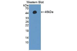 Western Blotting (WB) image for anti-Protein Phosphatase, Mg2+/Mn2+ Dependent, 1A (PPM1A) (AA 2-382) antibody (ABIN1869913) (PPM1A anticorps  (AA 2-382))