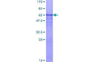 Image no. 1 for Ras Interacting Protein 1 (RASIP1) (AA 1-317) protein (GST tag) (ABIN1317509)