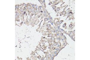 Immunohistochemistry of paraffin-embedded rat testis using MTOR antibody.