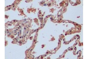 Detection of IDH1 in Human Lung Tissue using Polyclonal Antibody to Isocitrate Dehydrogenase 1, Soluble (IDH1) (IDH1 anticorps  (AA 74-333))