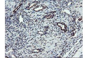 Image no. 13 for anti-TSC22 Domain Family, Member 1 (TSC22D1) antibody (ABIN1501540) (TSC22D1 anticorps)