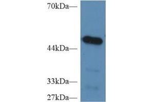 Detection of CPB2 in Mouse Heart lysate using Polyclonal Antibody to Carboxypeptidase B2 (CPB2) (CPB2 anticorps  (AA 113-422))