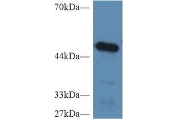 CPB2 antibody  (AA 113-422)