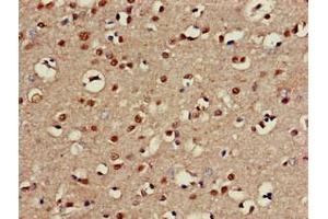 Immunohistochemistry of paraffin-embedded human brain tissue using ABIN7146672 at dilution of 1:100