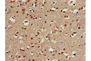 Immunohistochemistry of paraffin-embedded human brain tissue using ABIN7146672 at dilution of 1:100 (CHST1 anticorps  (AA 305-397))