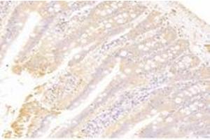 Immunohistochemistry analysis of paraffin-embedded rat duodenum using,CTSV (ABIN7073348) at dilution of 1: 2000 (Cathepsin L2 anticorps)